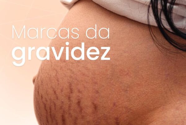 Pele na gravidez